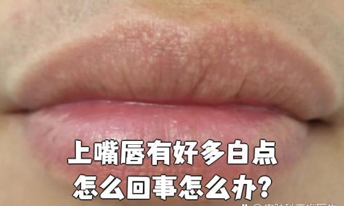 月经期间喝阿胶红糖水网月经期间喝阿胶红糖水是饭前喝还是饭后喝?知识网站,分享姨妈期可以喝阿胶红糖水吗大全